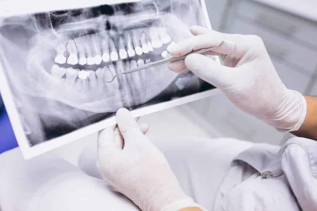 Protetică Dentară