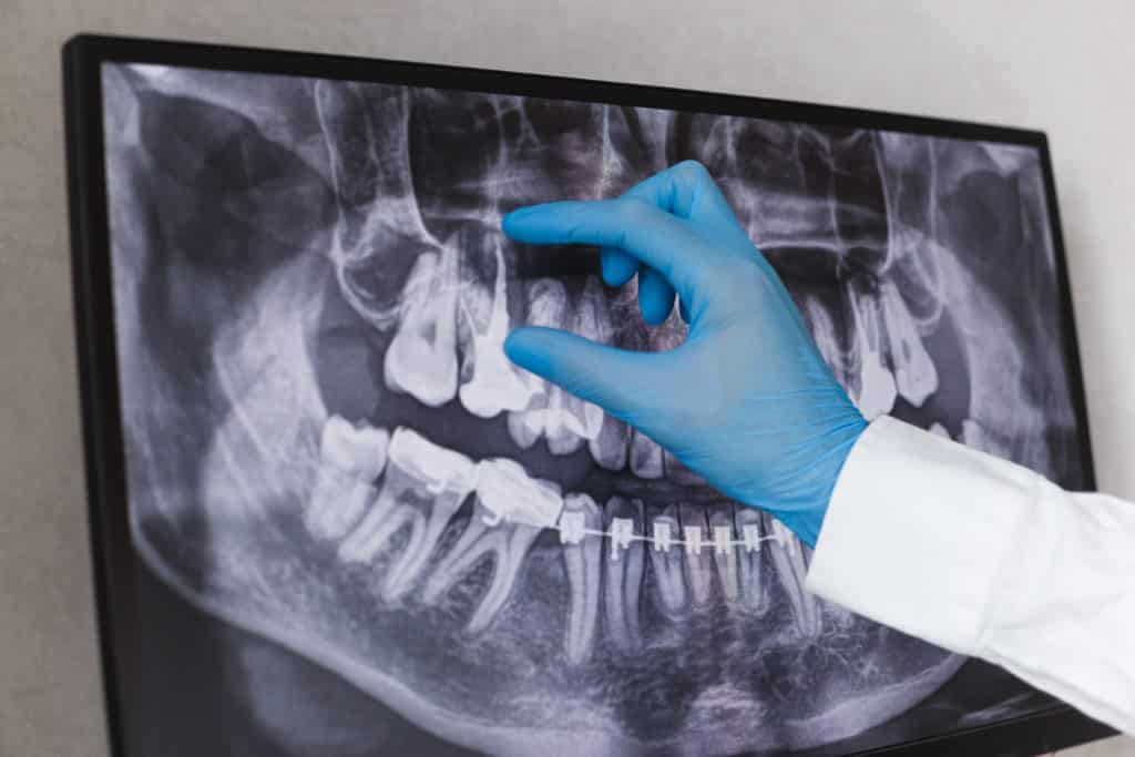 Endodonție Sibiu