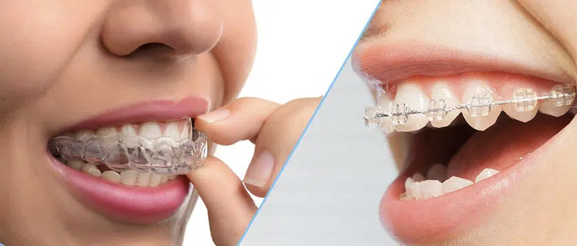 Aparat dentar Sibiu