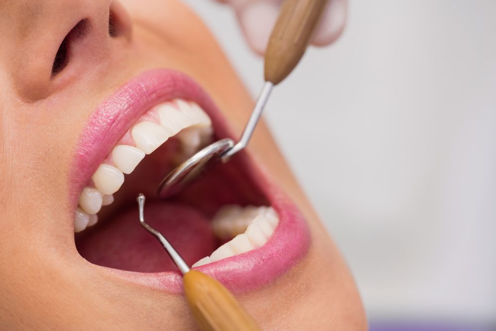 Profilaxie dentară